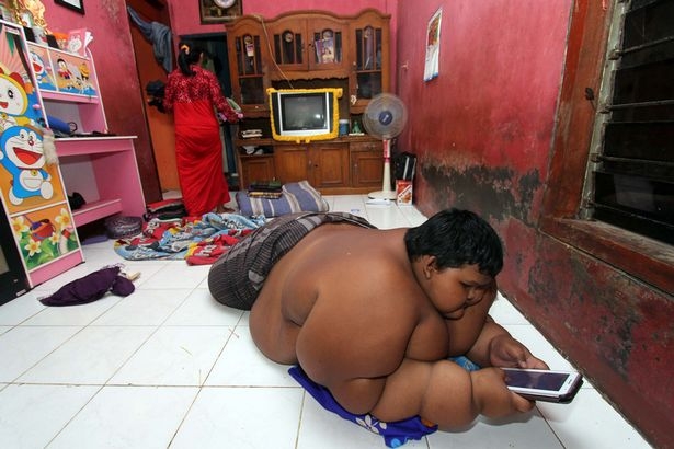 В 10 лет 192 килограмма: в Индонезии живет самый толстый ребенок в мире