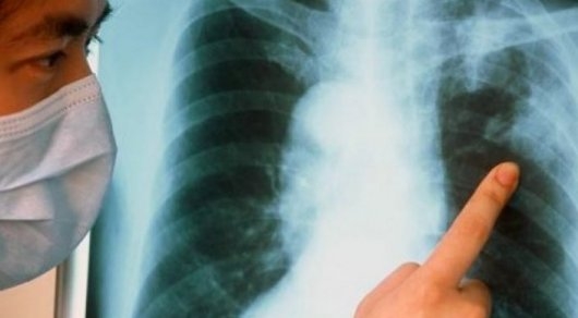 В Алматы больные туберкулезом уклоняются от лечения